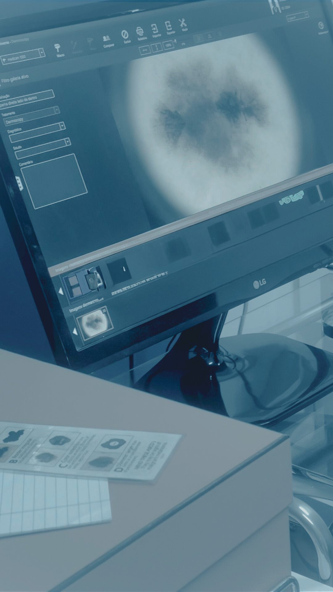 DERMATOSCOPIA DIGITAL DR TOVO